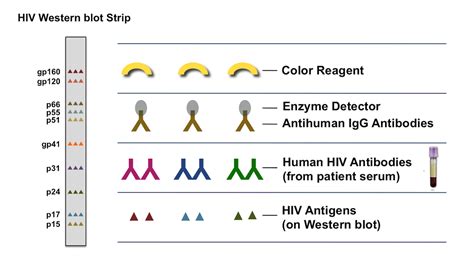 elisa test vs western blot|hiv confirmatory test western blot.